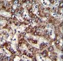 TRIM59 Antibody - TRIM59 Antibody immunohistochemistry of formalin-fixed and paraffin-embedded human liver tissue followed by peroxidase-conjugated secondary antibody and DAB staining.