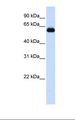TRIM60 Antibody - Fetal brain lysate. Antibody concentration: 1.0 ug/ml. Gel concentration: 12%.  This image was taken for the unconjugated form of this product. Other forms have not been tested.