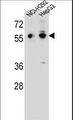 TRIM64 Antibody - TRIM64 Antibody western blot of NCI-H292,HepG2 cell line lysates (35 ug/lane). The TRIM64 antibody detected the TRIM64 protein (arrow).