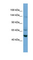 TRIM66 Antibody - TRIM66 antibody Western blot of A549 cell lysate. This image was taken for the unconjugated form of this product. Other forms have not been tested.