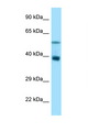 TRIM7 Antibody - TRIM7 antibody Western blot of Rat Liver lysate. Antibody concentration 1 ug/ml.  This image was taken for the unconjugated form of this product. Other forms have not been tested.