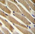 TRIM7 Antibody - TRIM7 Antibody immunohistochemistry of formalin-fixed and paraffin-embedded human skeletal muscle followed by peroxidase-conjugated secondary antibody and DAB staining.