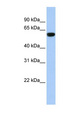 TRIM72 / MG53 Antibody - TRIM72 antibody Western blot of Fetal Muscle lysate. This image was taken for the unconjugated form of this product. Other forms have not been tested.