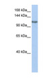 Trimethylguanosine Synthase 1 Antibody - TGS1 antibody Western blot of HepG2 cell lysate. This image was taken for the unconjugated form of this product. Other forms have not been tested.