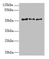 TRIML1 Antibody - Western blot All lanes: TRIML1 antibody at 3µg/ml Lane 1: Mouse kidney tissue Lane 2: Human placenta tissue Lane 3: A431 whole cell lysate Secondary Goat polyclonal to rabbit IgG at 1/10000 dilution Predicted band size: 53 kDa Observed band size: 53 kDa