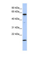 TRIP10 / CIP4 Antibody - TRIP10 / CIP4 antibody Western blot of Jurkat lysate. This image was taken for the unconjugated form of this product. Other forms have not been tested.