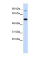 TRMT1 Antibody - TRMT1 antibody Western blot of 293T cell lysate. This image was taken for the unconjugated form of this product. Other forms have not been tested.