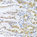 TRMT1 Antibody - Immunohistochemistry of paraffin-embedded human stomach tissue.