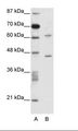 TRMT1L Antibody - A: Marker, B: Jurkat Cell Lysate.  This image was taken for the unconjugated form of this product. Other forms have not been tested.