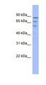 TRMT1L Antibody - TRMT1L / C1orf25 antibody Western blot of ACHN lysate. This image was taken for the unconjugated form of this product. Other forms have not been tested.