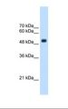 TRMT2B Antibody - HepG2 cell lysate. Antibody concentration: 2.5 ug/ml. Gel concentration: 12%.  This image was taken for the unconjugated form of this product. Other forms have not been tested.