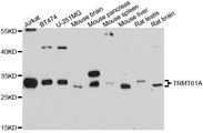 TRMT61A / TRM61 Antibody - Western blot analysis of extracts of various cell lines, using TRMT61A antibody at 1:1000 dilution. The secondary antibody used was an HRP Goat Anti-Rabbit IgG (H+L) at 1:10000 dilution. Lysates were loaded 25ug per lane and 3% nonfat dry milk in TBST was used for blocking. An ECL Kit was used for detection and the exposure time was 10s.