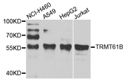 TRMT61B Antibody - Western blot analysis of extracts of various cell lines.