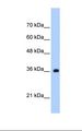 TRNAU1AP / TRSPAP1 Antibody - Jurkat cell lysate. Antibody concentration: 1.25 ug/ml. Gel concentration: 12%.  This image was taken for the unconjugated form of this product. Other forms have not been tested.