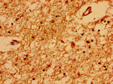 TRNP1 Antibody - Immunohistochemistry of paraffin-embedded human brain tissue using TRNP1 Antibody at dilution of 1:100