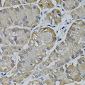 TRPC3 Antibody - Immunohistochemistry of paraffin-embedded human stomach tissue.