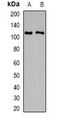 TRPC4 Antibody - Western blot analysis of TRPC4 expression in HeLa (A); mouse brain (B) whole cell lysates.