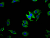 TRPM1 Antibody - Immunofluorescence staining of A549 cells diluted at 1:100, counter-stained with DAPI. The cells were fixed in 4% formaldehyde, permeabilized using 0.2% Triton X-100 and blocked in 10% normal Goat Serum. The cells were then incubated with the antibody overnight at 4°C.The Secondary antibody was Alexa Fluor 488-congugated AffiniPure Goat Anti-Rabbit IgG (H+L).