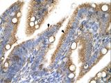 TRPM5 Antibody - TRPM5 antibody TRPM5(transient receptor potential cation channel, subfamily M, member 5) Antibody was used in IHC to stain formalin-fixed, paraffin-embedded human intestine.  This image was taken for the unconjugated form of this product. Other forms have not been tested.