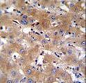 TRPM8 Antibody - TRPM8 Antibody immunohistochemistry of formalin-fixed and paraffin-embedded human liver tissue followed by peroxidase-conjugated secondary antibody and DAB staining.