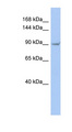 TRPV4 Antibody - TRPV4 antibody Western blot of HT1080 cell lysate. This image was taken for the unconjugated form of this product. Other forms have not been tested.