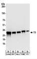 TS / Thymidylate Synthase Antibody - Detection of Human and Mouse TS by Western Blot. Samples: Whole cell lysate (50 ug) from Jurkat, 293T, HeLa, mouse TCMK-1, and mouse NIH3T3 cells. Antibodies: Affinity purified rabbit anti-TS antibody used for WB at 0.1 ug/ml. Detection: Chemiluminescence with an exposure time of 30 seconds.
