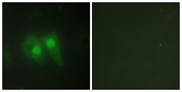TSAP6 / STEAP3 Antibody - Immunofluorescence analysis of HeLa cells, using STEA3 Antibody. The picture on the right is blocked with the synthesized peptide.