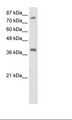 TSC22D2 Antibody - Transfected 293T Cell Lysate.  This image was taken for the unconjugated form of this product. Other forms have not been tested.