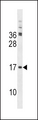 TSC22D3 / GILZ Antibody - TSC22D3 Antibody western blot of mouse kidney tissue lysates (35 ug/lane). The TSC22D3 antibody detected the TSC22D3 protein (arrow).