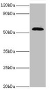 TSEN2 Antibody - Western blot All lanes: TSEN2 antibody at 5µg/ml + 293T whole cell lysate Secondary Goat polyclonal to rabbit IgG at 1/10000 dilution Predicted band size: 54, 52, 50, 48, 46 kDa Observed band size: 54 kDa