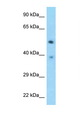 TSEN2 Antibody - TSEN2 antibody Western blot of Fetal Heart lysate. Antibody concentration 1 ug/ml.  This image was taken for the unconjugated form of this product. Other forms have not been tested.