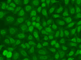 TSEN2 Antibody - Immunofluorescence analysis of A549 cells.