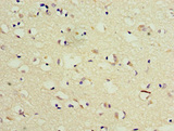 TSEN2 Antibody - Immunohistochemistry of paraffin-embedded human brain tissue at dilution 1:100