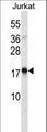 TSLP Antibody - TSLP Antibody western blot of Jurkat cell line lysates (35 ug/lane). The TSLP antibody detected the TSLP protein (arrow).