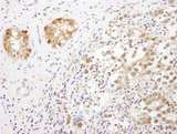 TSNAX / TRAX Antibody - Detection of human TRAX by immunohistochemistry. Sample: FFPE section of human testicular seminoma. Antibody: Affinity purified rabbit anti- TRAX used at a dilution of 1:5,000 (0.2µg/ml). Detection: DAB. Counterstain: IHC Hematoxylin (blue).