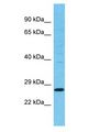 TSPAN11 Antibody - TSPAN11 antibody Western Blot of MCF7. Antibody dilution: 1 ug/ml.  This image was taken for the unconjugated form of this product. Other forms have not been tested.