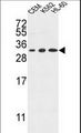 TSPAN2 Antibody - TSPAN2 Antibody western blot of CEM,K562,HL-60 cell line lysates (35 ug/lane). The TSPAN2 antibody detected the TSPAN2 protein (arrow).