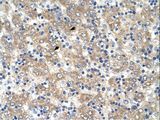 TSPAN32 / PHEMX Antibody - TSPAN32 / PHEMX antibody TSPAN32(tetraspanin 32) Antibody was used in IHC to stain formalin-fixed, paraffin-embedded human liver.  This image was taken for the unconjugated form of this product. Other forms have not been tested.