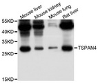 TSPAN4 Antibody - Western blot analysis of extract of various cells.