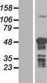 TSPYL4 Protein - Western validation with an anti-DDK antibody * L: Control HEK293 lysate R: Over-expression lysate