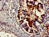 TSR2 Antibody - Immunohistochemistry of paraffin-embedded human lung tissue at dilution of 1:100