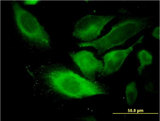 TSSC1 Antibody - Immunofluorescence of monoclonal antibody to TSSC1 on HeLa cell. [antibody concentration 10 ug/ml]