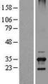 TSSK6 Protein - Western validation with an anti-DDK antibody * L: Control HEK293 lysate R: Over-expression lysate