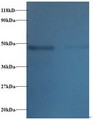 TTC1 Antibody - Western blot of Tetratricopeptide repeat protein 1 antibody at 2 ug/ml. Lane 1:293T whole cell lysate. Lane 2: EC109 whole cell lysate. Secondary: Goat polyclonal to Rabbit IgG at 1:15000 dilution. Predicted band size: 32 kDa. Observed band size: 45 kDa.  This image was taken for the unconjugated form of this product. Other forms have not been tested.