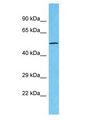 TTC39C Antibody - TTC39C antibody Western Blot of Fetal Lung. Antibody dilution: 1 ug/ml.  This image was taken for the unconjugated form of this product. Other forms have not been tested.