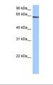 TTC6 Antibody - Jurkat cell lysate. Antibody concentration: 0.5 ug/ml. Gel concentration: 12%.  This image was taken for the unconjugated form of this product. Other forms have not been tested.