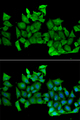 TTF / RHOH Antibody - Immunofluorescence analysis of MCF-7 cells.