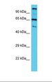 TTLL10 Antibody - Western blot of Human HepG2. TTLL10 antibody dilution 1.0 ug/ml.  This image was taken for the unconjugated form of this product. Other forms have not been tested.