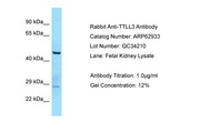 TTLL3 Antibody -  This image was taken for the unconjugated form of this product. Other forms have not been tested.