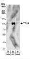 TTLL4 Antibody - Detection of Human TTLL4 by Western Blot. Samples: Whole cell lysate (50 ug) from HeLa, 293T, and Jurkat cells. Antibodies: Affinity purified rabbit anti-TTLL4 antibody used for WB at 0.4 ug/ml. Detection: Chemiluminescence with an exposure time of 3 minutes.